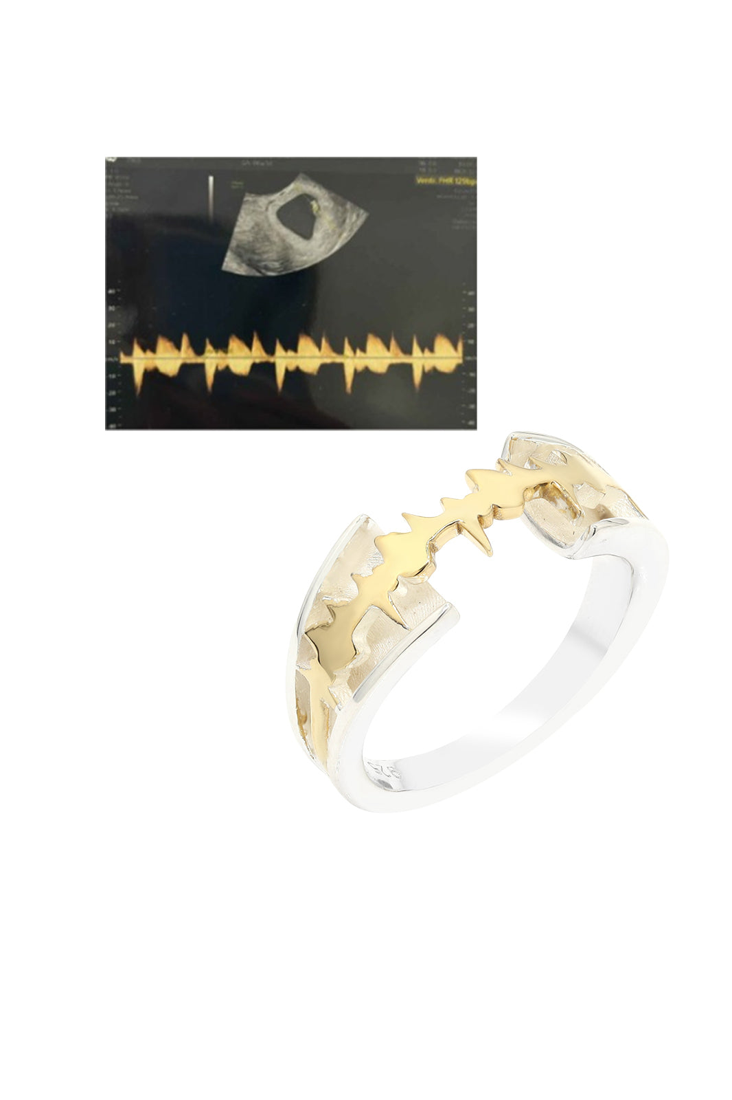 Personalised Lubb-Dupp Crown Loop