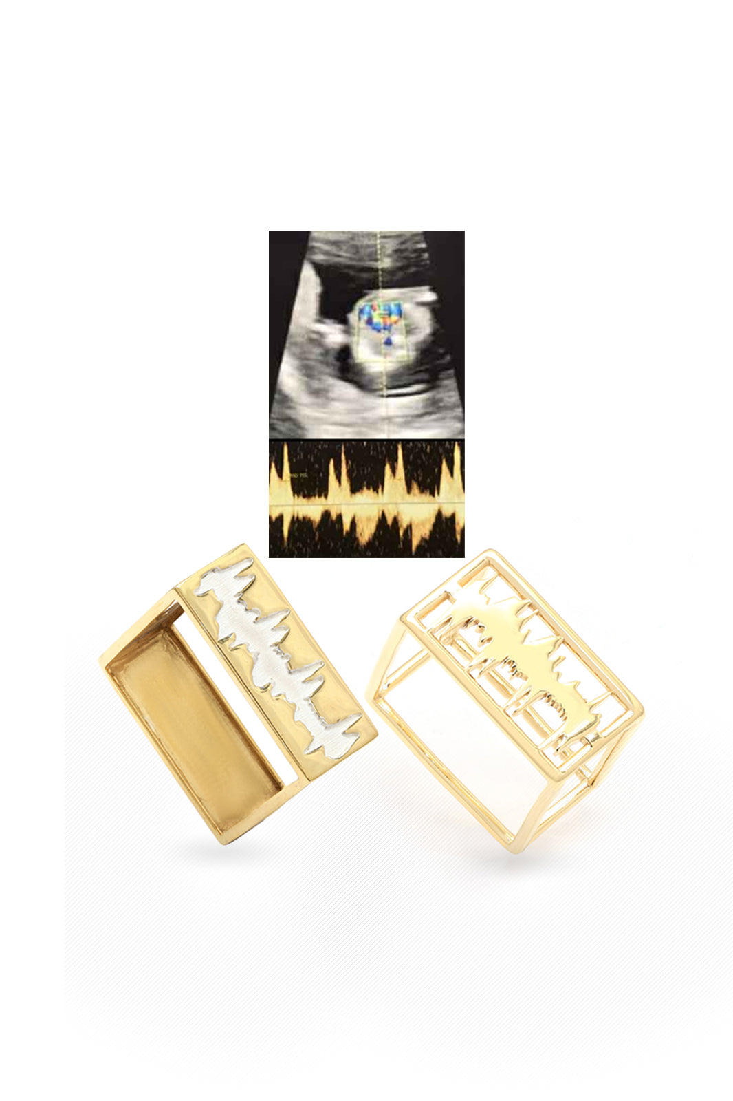 Personalised Lubb-Dupp Quad VOW Loops