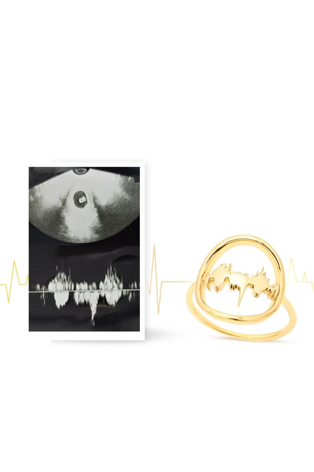 Gold Lubb-Dupp Loop ring showcasing a baby's heartbeat design in a modern circular structure, crafted in polished gold.