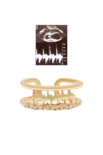 Personalised Lubb-Dupp Textured Loop