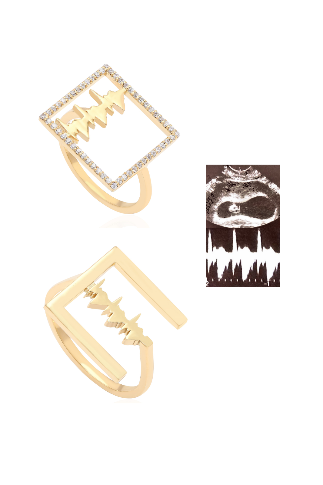 Personalised Lubb-Dupp Squared VOW Loops