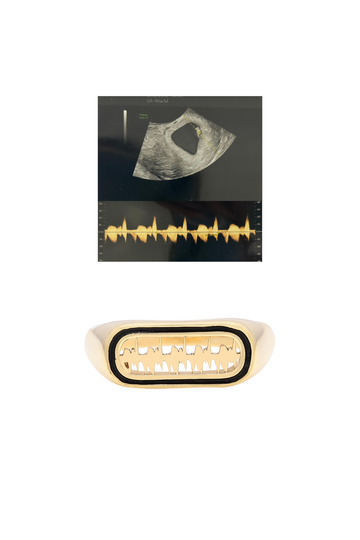 Personalised Lubb-Dupp Raised Enamel Loop