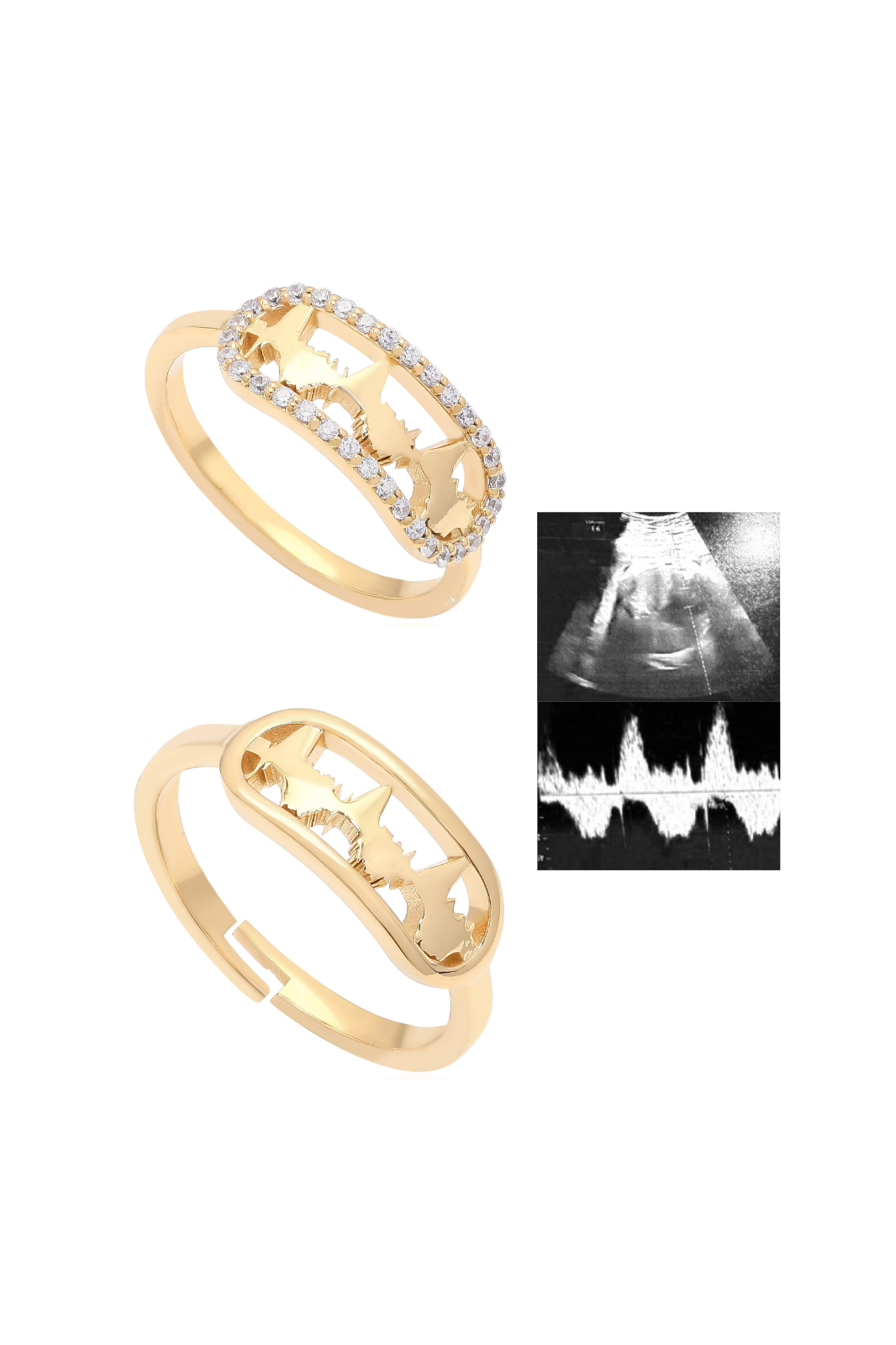 Personalised Lubb-Dupp Squircle VOW Loops