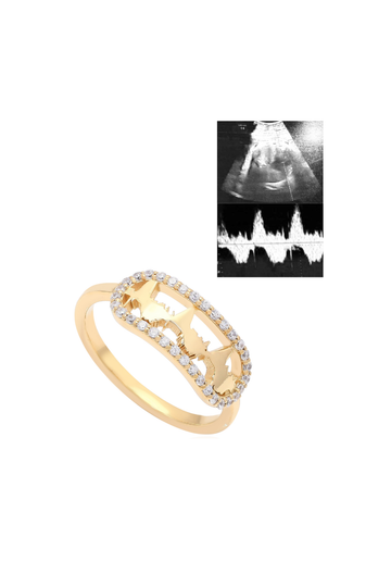 Personalised Lubb-Dupp Squricle Loop