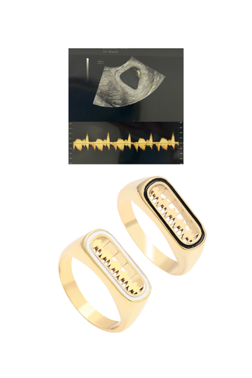Personalised Lubb-Dupp Raised Enamel VOW Loops