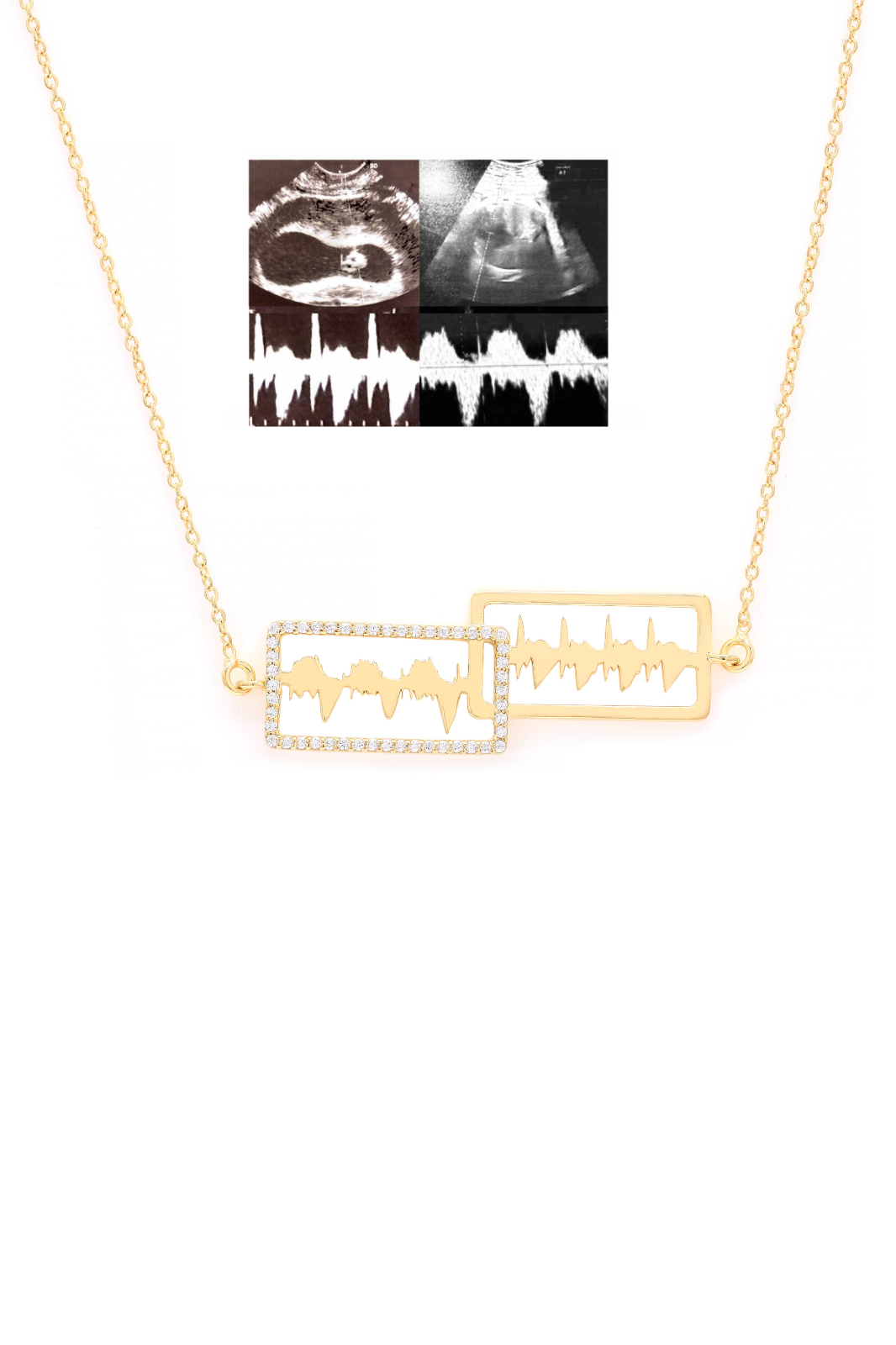 Personalised Lubb-Dupp Squircle Duo Necklet With Chain