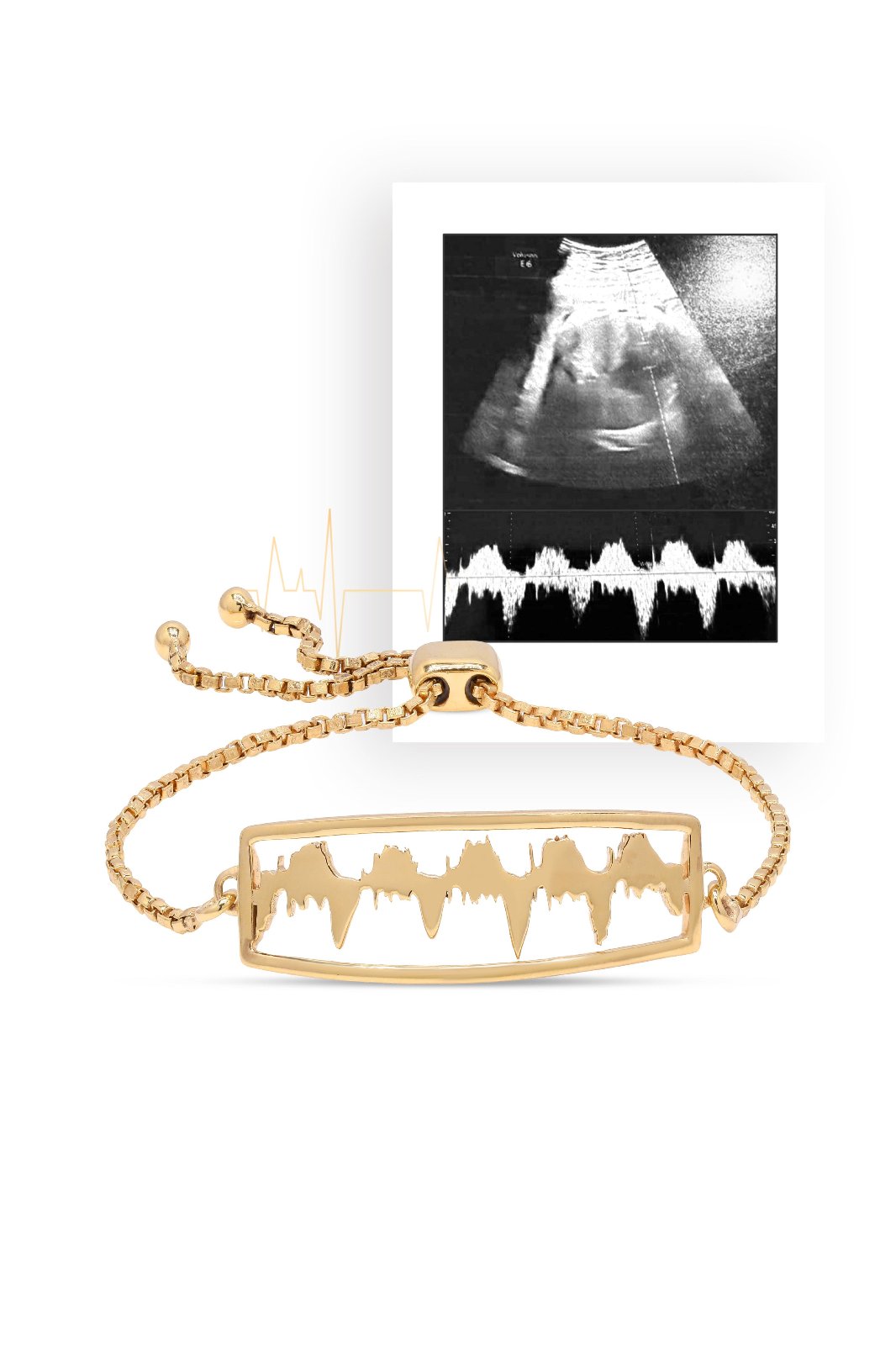 Gold Lubb-Dupp bracelet displayed with baby heartbeat sonogram, symbolizing a heartfelt keepsake for parents